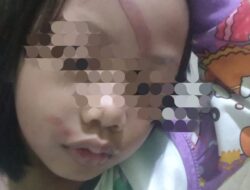 Nasip Vanya Shumaila Bocah 5 Tahun Yang di Aniaya Bapak Tirinya di Pondok Cabe